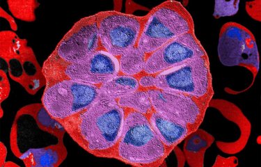 Vers de nouveaux médicaments efficaces contre le paludisme